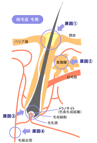 ラ・フィーネ毛根図